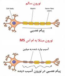ms-3